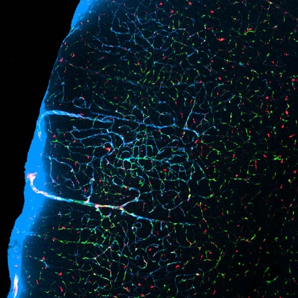 Toxins flushed out via bright blue channels between brain cells. Image from Science Mag summary linked above.